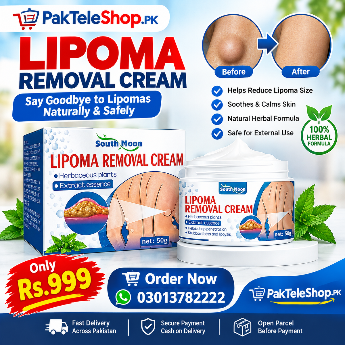 Lipoma Removal Cream Price In Pakistan